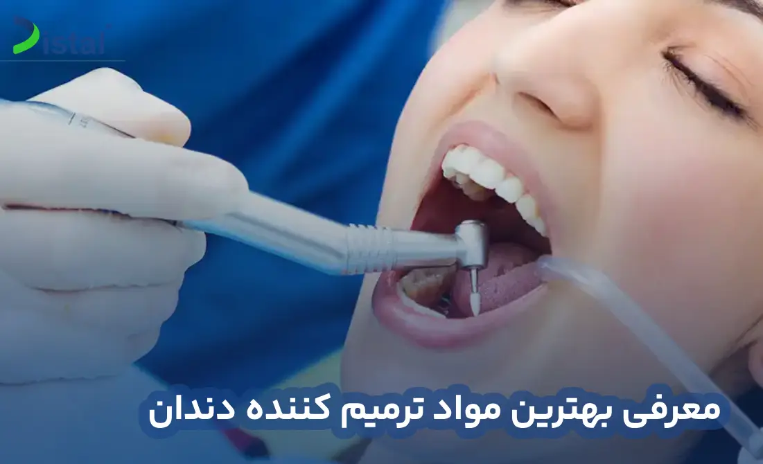 معرفی بهترین مواد ترمیم کننده دندان