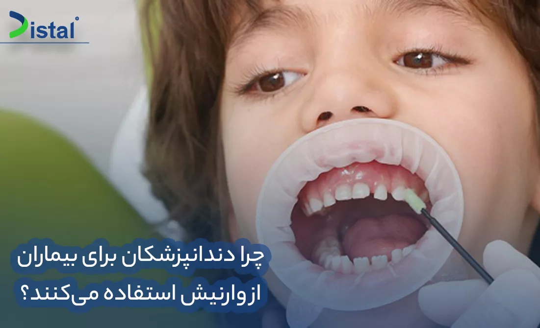 چرا دندانپزشکان برای بیماران از وارنیش استفاده می‌کنند؟